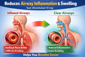 Kast 10 mg tablet | Montelukast 10 mg tablet