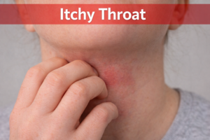 Fexon 180 mg Tablet Uses