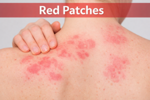 Fexofenadine 180 mg Tablet